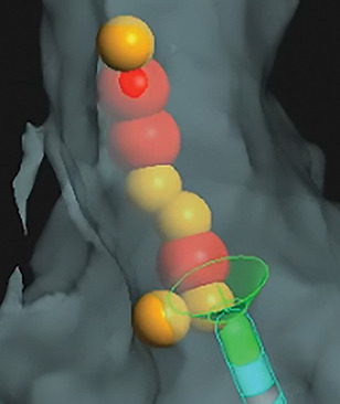 Cardiac mapping image with the Metrics integration display of the TactiCath Contact Force Ablation Catheter, SE.