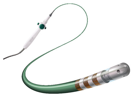 TactiCath Contact Force Ablation Catheter, Sensor Enabled