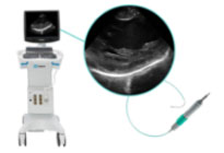 ViewMate Ultrasound Console with ViewFlex Xtra ICE Catheter