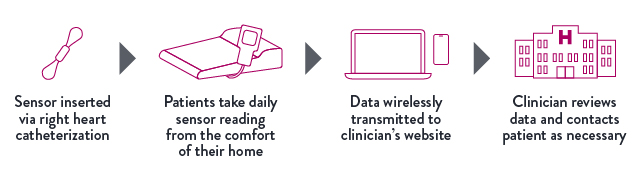 CardioMEMS-graphics