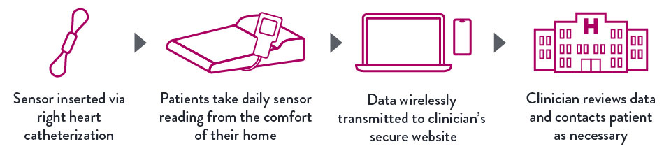  The CardioMEMS HF System Sends PA Pressure Data from Patients’ Homes to You