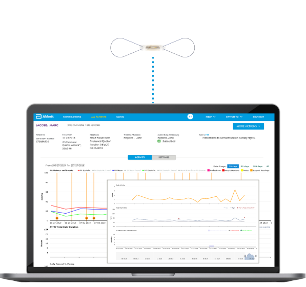 Data-driven insights from the CardioMEMS HF System