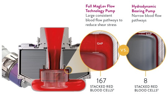 Cut across view of the HeartMate 3 Maglev Pump