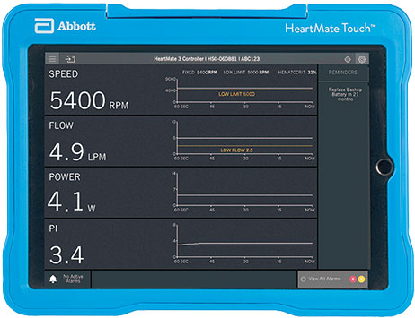 Monitor of the HeartMate Touch Communication System