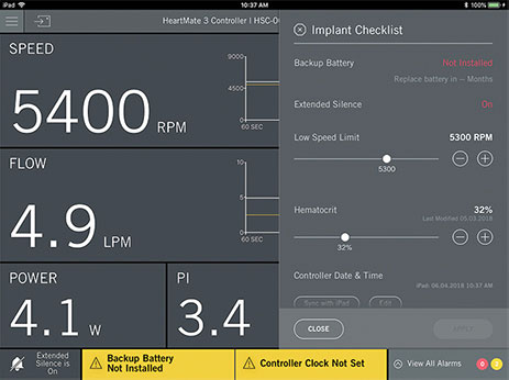 Sample Implant Checklist in the HeartMate Touch Communication System