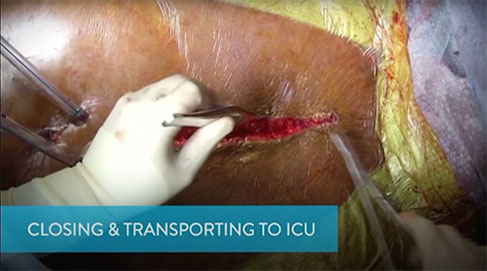 Closing and Transitioning to the ICU