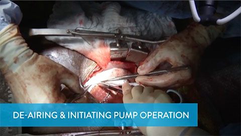 De-Airing & Initiating Pump Operation Video