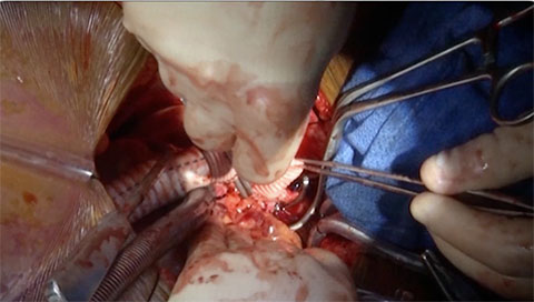 De-Airing & Initiating Pump Operation Video