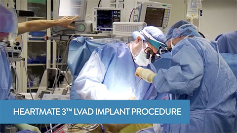 HeartMate 3 LVAD Implant Procedure Overview