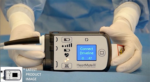 Setting up the System Controller Video