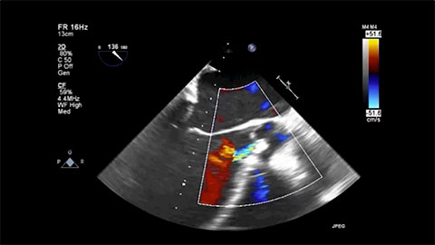 Patient Preparation Video
