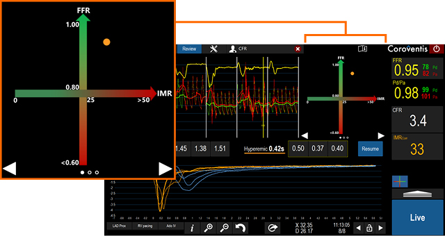 Coroflow full physiology result matrix