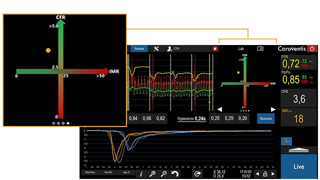 Coroflow Coroventis screen