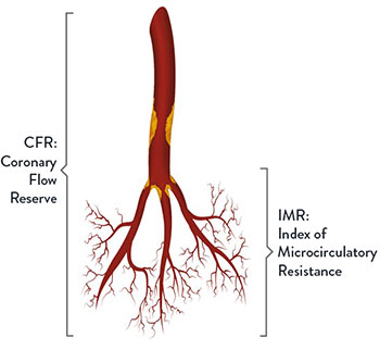 IMR and CFR