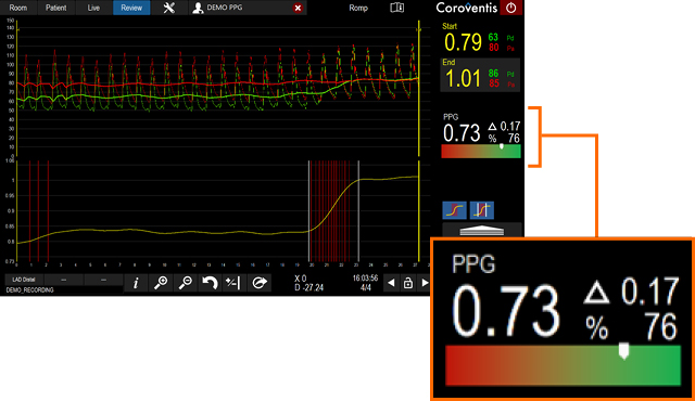 Coroflow full physiology insights with PPG