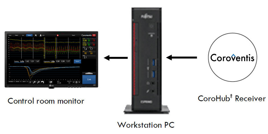 Coroventis‡ CoroHub‡ System plus micro PC