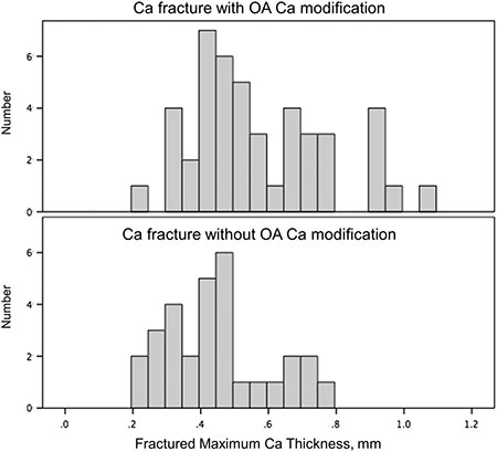 Distribution of Maximum Fractured Calcium thickness