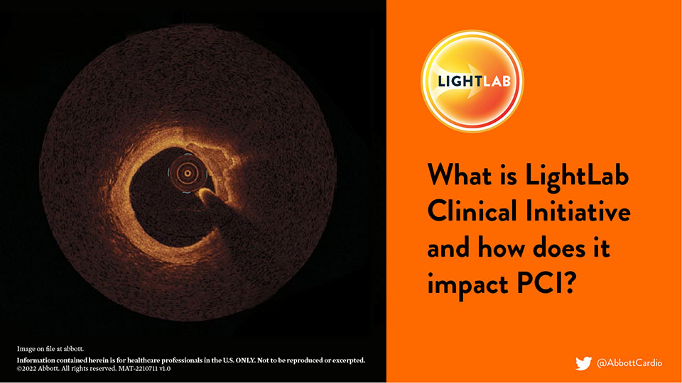  LightLab Study Key Takeaways