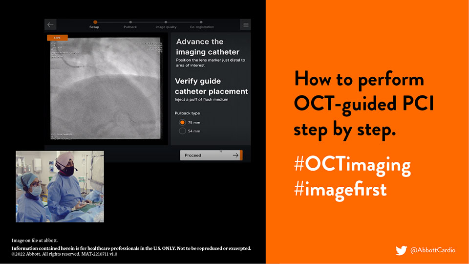  How to perform OCT-guided PCI step by step