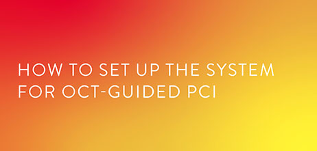 How to set up the system for OCT-guided PCI