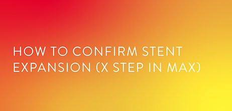 How to confirm stent expansion using MLD MAX
