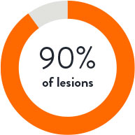iOPTICO Study