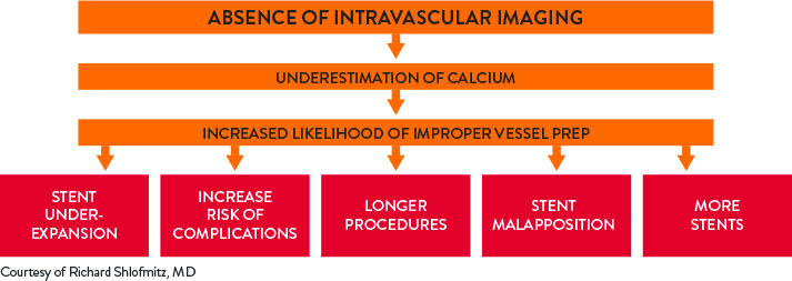 Absence of Intravascular Imaging Results