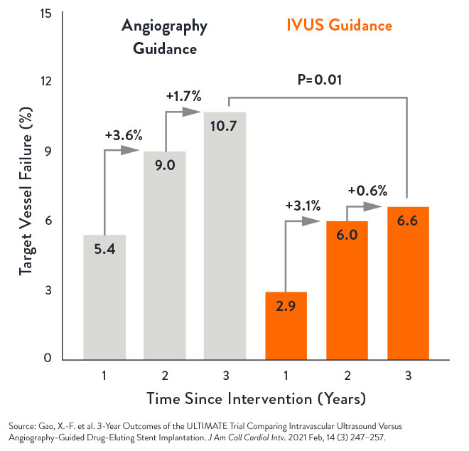 Angiography vs IVUS Guidance