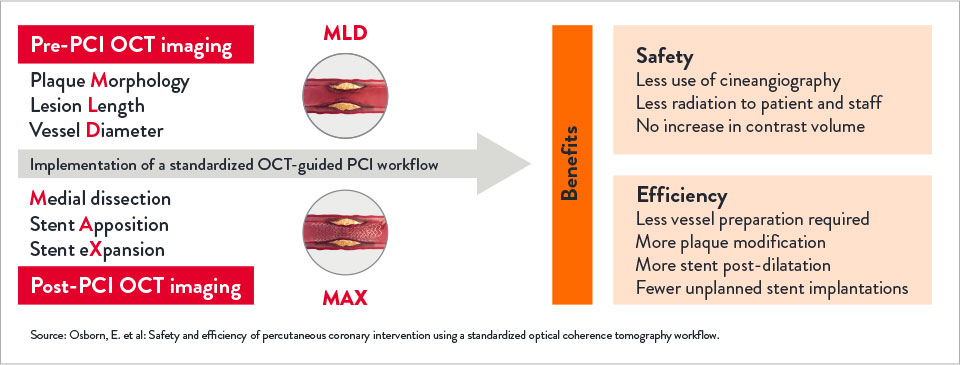 Pre and Post PCI OCT Imaging Benefits