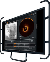 OPTIS™ Imaging Systems