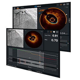 Ultreon™ 1.0 Software