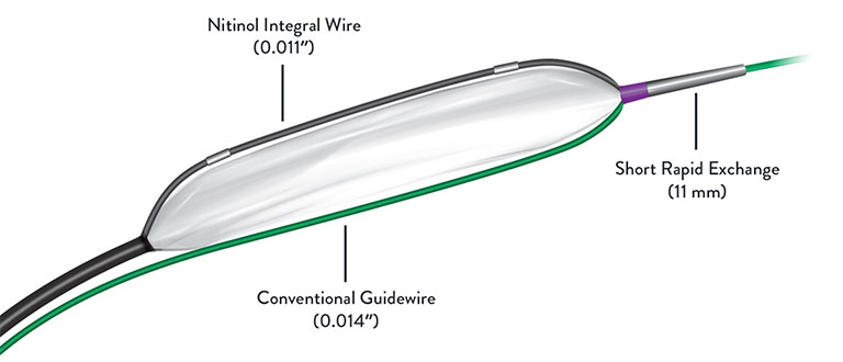 Scoreflex Diagram