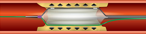 Scoreflex Focused Force