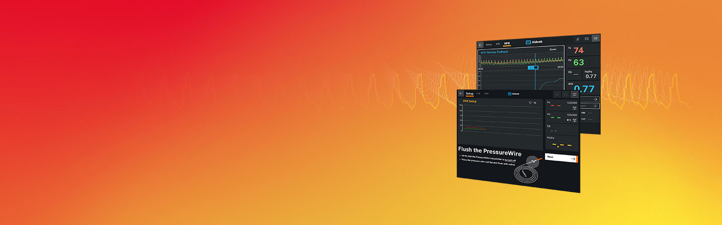 Ultreon 1.0 Software has step-by-step guidance to streamline the use of OCT intravascular imaging and RFR/FFR, prioritizing ease of use for interventional cardiologists (ICs)