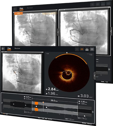 Ultreon™ 1.0 Software