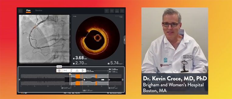 How can Ultreon™ 2.0 Software support PCI