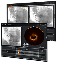 Ultreon Software