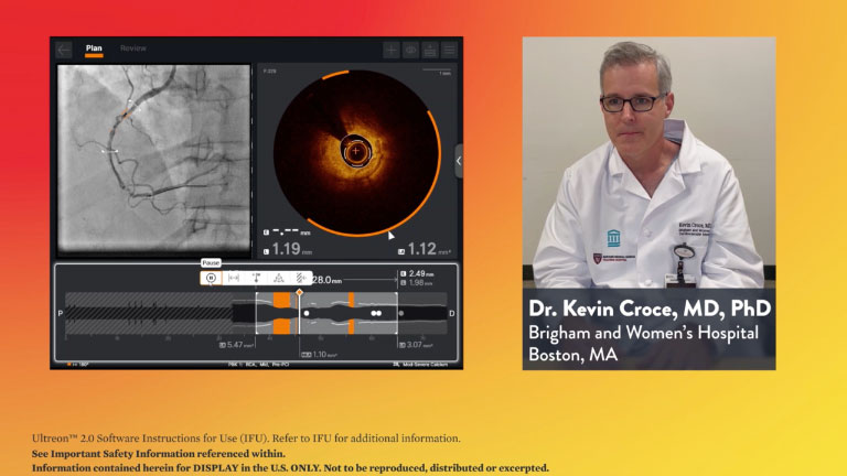 How can Ultreon™ 2.0 Software support PCI