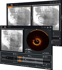 ULTREON™ 2.0 Software