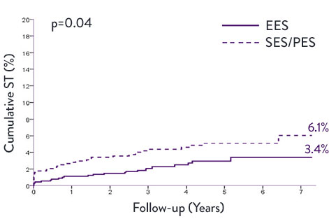 7-year data show that, vs first generation DES, XIENCE second generation DES has significantly lower ST and TVR.