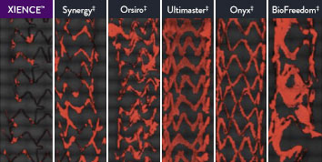 XIENCE™ Stent is thromboresistant, showing significantly less (p < 0.01) platelet adhesion than Synergy,‡ Orsiro,‡ Ultimaster,‡ Onyx,‡ and BioFreedom‡ DES.