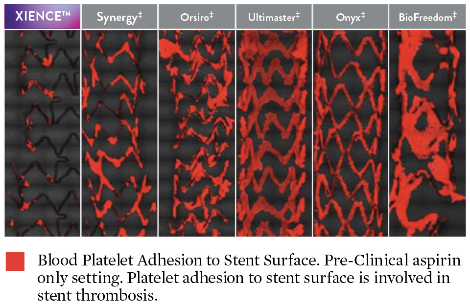 pci xience stent fluoro