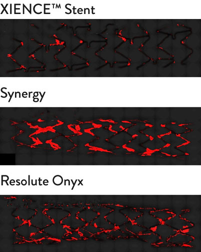 XIENCE Stent shows significantly less platelet adhesion vs other stents: Synergy, Resolute Onyx, Biofreedom