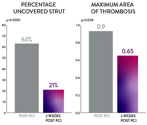 By 2 weeks post PCI XIENCE data shows ~80% strut coverage and significantly less thrombus than immediately post PCI.