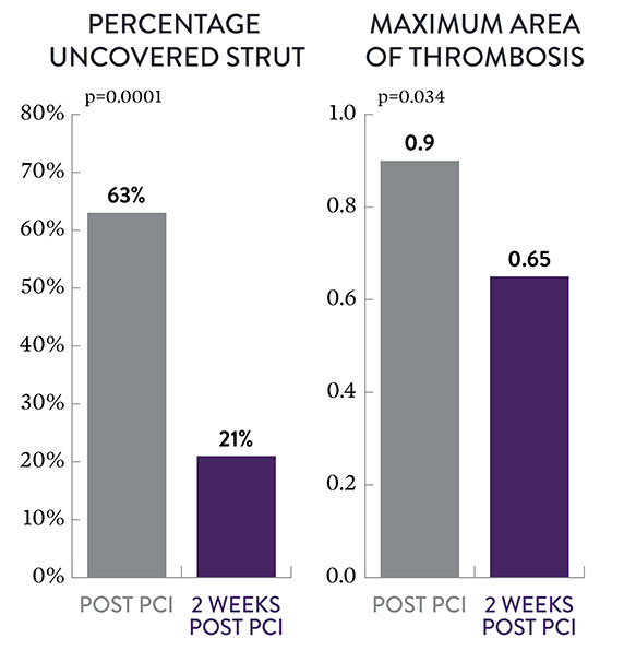 By 2 weeks post PCI XIENCE data shows ~80% strut coverage and significantly less thrombus than immediately post PCI.