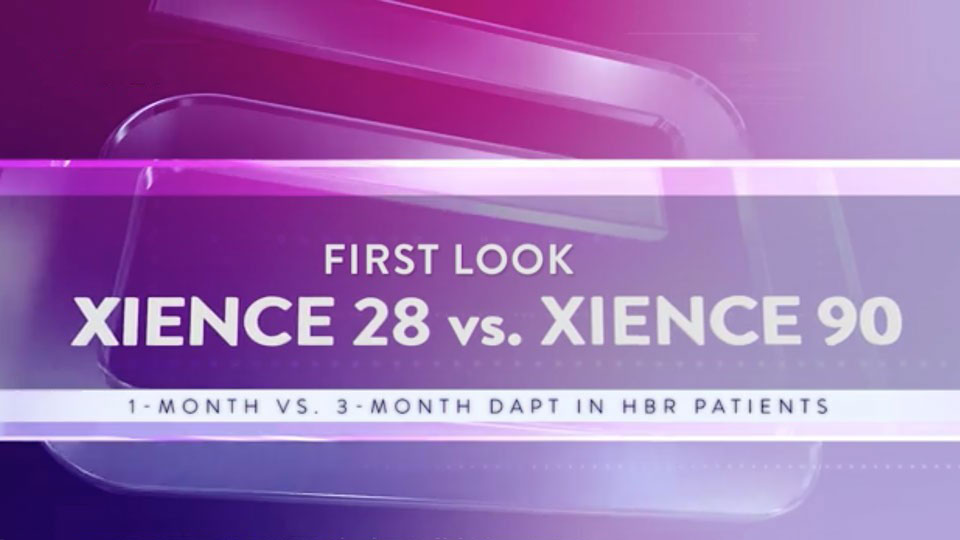 First look XIENCE 28 vs. XIENCE 90