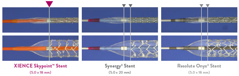 Scaffolding comparison to Synergy and Resolute Onyx
