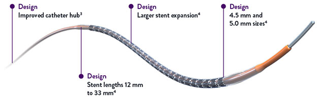 Skypoint Stent Diagram