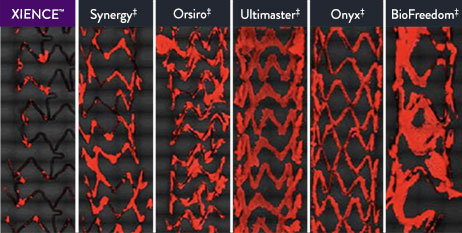 XIENCE Stent has much lower platelet adhesion compared to Synergy, Orsiro, Ultimaster, Onyx, and BioFreedom drug-eluting stents 