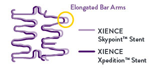 The 48-mm XIENCE Skypoint™ Stent’s design enhancements allow for improved expansion.